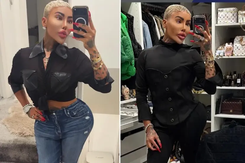 Kim Kardashian'a benzemek için estetik yaptıran fenomen hayatını kaybetti: 2 kişi cinayetten tutuklandı