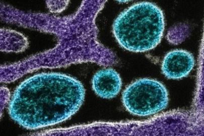 DSÖ, Atlas Okyanusu'ndaki gemide 7 hantavirüs vakası belirlendiğini bildirdi
