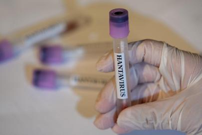 'MV Hondius' gemisinden tahliye edilen 1 kişinin daha hantavirüs testi pozitif çıktı